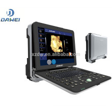 DW-C300 High-End-portable 4D Funktion Farbdoppler Ultraschallgerät